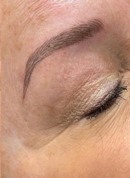 8445-Med-Spa-Brow-After
