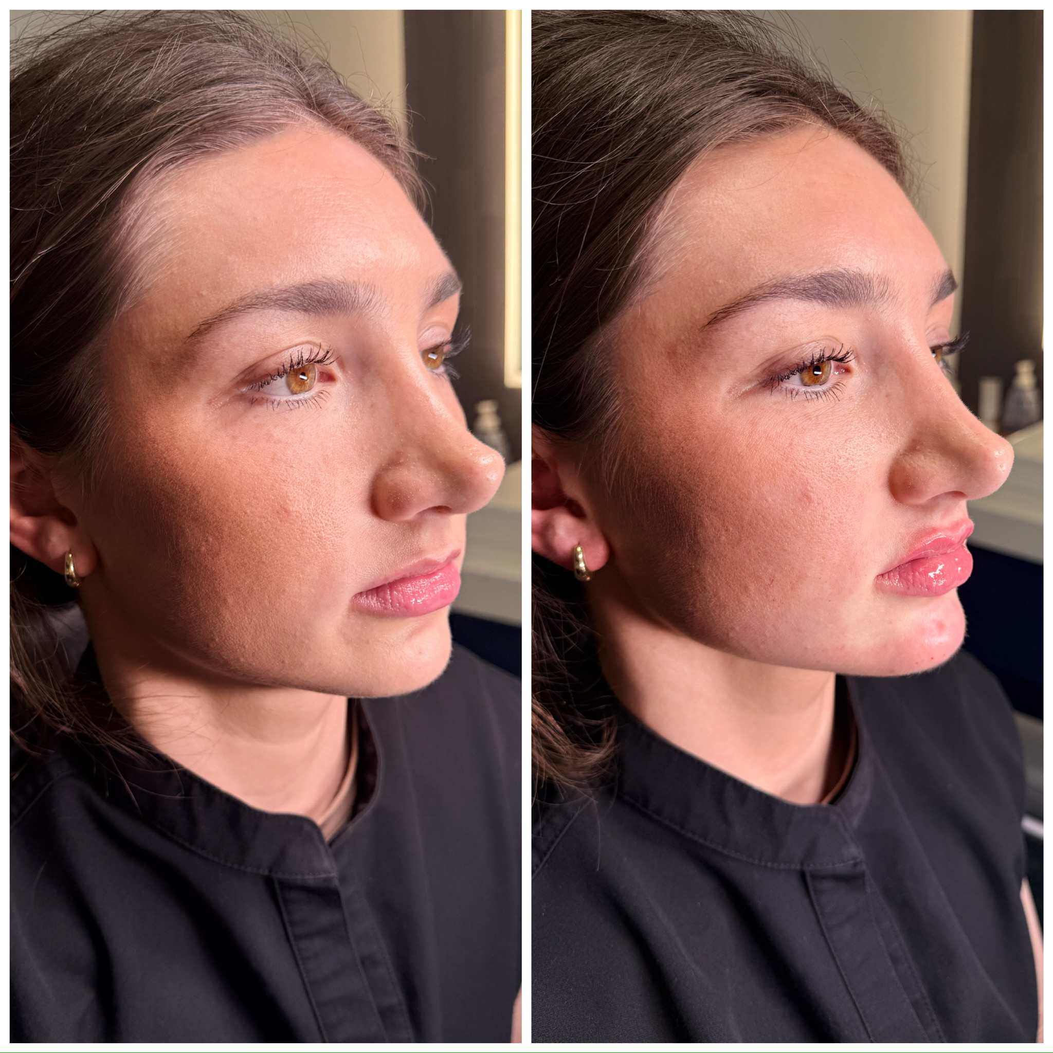 Facial Balancing